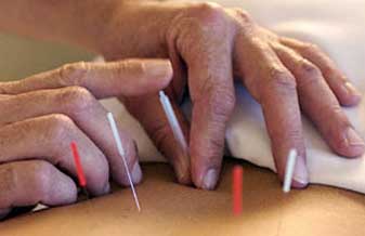 Clínica de Acupuntura Professor Liu Jianguang - Foto 1