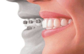 Odontoprev Previdência Odontológica - Foto 1